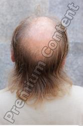 Hair Man White Overweight Bald